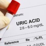 Ácido úrico alto: causas Acido urico alto causas