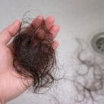 Caida del cabello en mechones