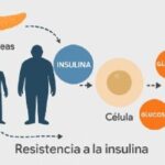 Diabetes 2