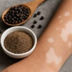 Pimiento negra quitar manchas vitiligo
