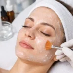 Contraindicaciones peeling