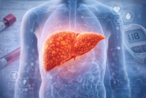 Esteatosis hepática