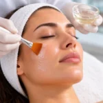 Peeling quimico para manchas
