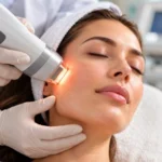 Tratamientos con laser acne cicatrices y arrugas