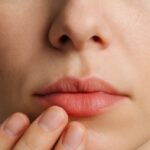 Adormecimiento en labios