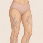 Biodescodificacion varices