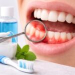 Encías inflamadas: causas y soluciones Encias inflamadas
