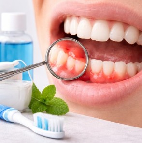 Encías inflamadas: causas y soluciones