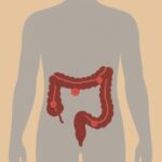 biodescodificacion polipos colon