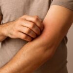 Problemas hepáticos causan picazón en la piel Como eliminar picazon cuerpo