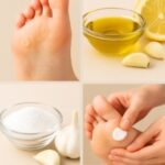 Remedios naturales callos pies