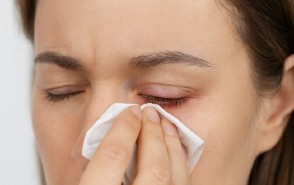 conjuntivitis alérgica