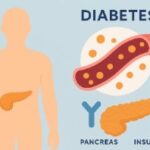 La Diabetes diabetes