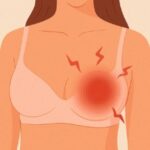 ¿Qué es la mastitis? Causas, síntomas y tratamiento efectivo Mastitis