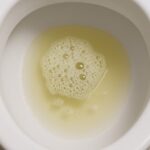 ¿Notas burbujas en la orina con frecuencia? burbujas en la orina