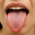 ¿Por qué tengo sabor metálico en la boca? Diferentes razones según el contexto sabor metalico en la boca