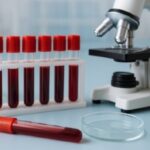 ¿Qué significa tener las transaminasas altas en sangre? transaminasas altas en sangre