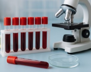 ¿Qué significa tener las transaminasas altas en sangre?
