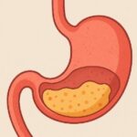 Gastroparesia: Sensación de estómago lleno gastroparesia