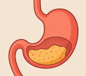 gastroparesia