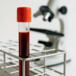 Qué significa la hemoglobina baja en un examen de sangre Hemoglobina baja resultados