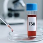 Valores normales de la TSH y qué significa tenerla alterada TSH valores normales