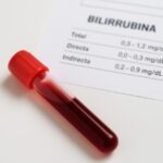Bilirrubina total y fraccionada: qué significa en un análisis de sangre Valores bilirrubina laboratorio