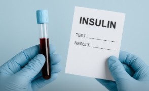 Niveles normales de insulina en sangre