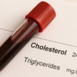 colesterol HDL alto