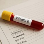 ¿Qué significa vitamina D en 20 ng/ml? vitamina D en 20