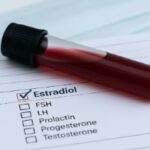 Analisis de estradiol