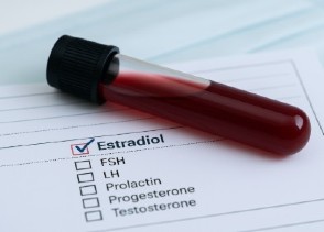 Analisis de estradiol