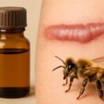 Apitoxina para quitar cicatrices queloides Apitoxina para quitar cicatrices queloides