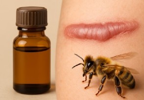 Apitoxina para quitar cicatrices queloides
