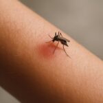 Chikungunya: Causas, síntomas y tratamiento Chikungunya