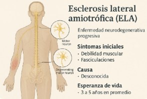 Qué es la ELA
