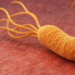 Helicobacter pylori resistente: causas, síntomas y tratamientos actuales Helicobacter pylori resistente