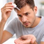 Efecto Shedding: ¿Por qué se cae más el pelo al usar Minoxidil? Shedding minoxidil