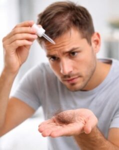 ¿Por qué se cae más el pelo al usar Minoxidil?