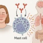 Síndrome de activación mastocitaria: síntomas, causas y tratamiento Síndrome de activación mastocitaria