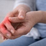 Síntomas de Artritis Sintomas artritis