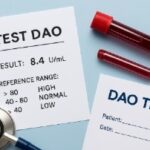 Qué es el test DAO para qué sirve