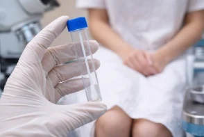 Leucocitos en exudado vaginal