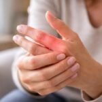 Dolor en dedos de la mano