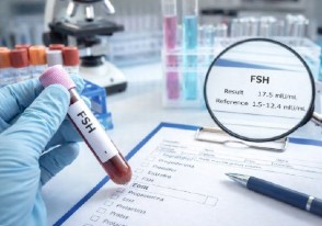 FSH alta: qué significa