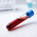 proteína c reactiva elevada