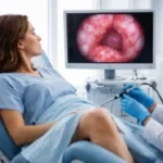Mal olor en el flujo después de histeroscopia Mal olor flujo despues histeroscopia