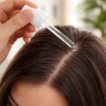 Minoxidil para la caída del cabello Monoxidil