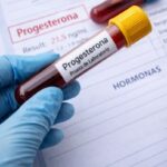Progesterona baja: síntomas, causas y tratamiento natural Progesterona baja sintomas