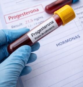 Progesterona baja sintomas
